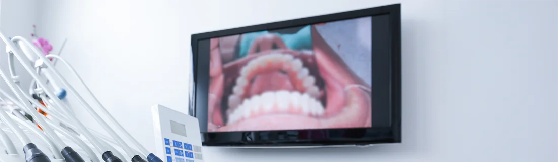 DIAGNOdent in Waterford Township MI