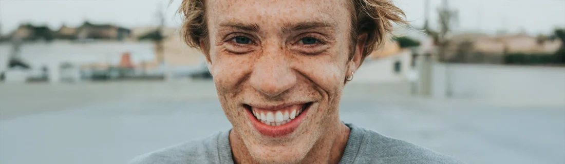 FC – Straightening Teeth with Clear Aligners at Hi-Tech Dentistry